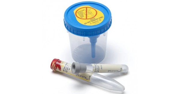 Buy BD Vacutainer Urine Collection System Get Price For Lab Equipment