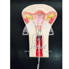 IUD Model