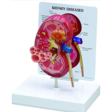 Kidney Anatomy Model