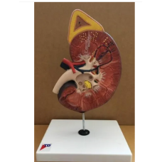 Human Kidney Model