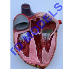 Infective Endocarditis Pathology Model