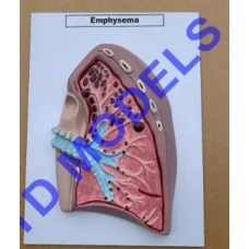 Emphysema Pathology Model