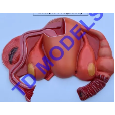 Ectopic Pregnancy Pathology Model