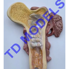 Chondrosarcoma Pathology Model