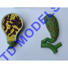 Cholelithiasis Pathology Model