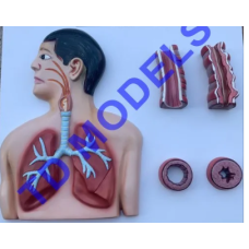 Asthma Pathology Model