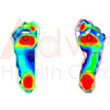 Simple Plantar Pressure System