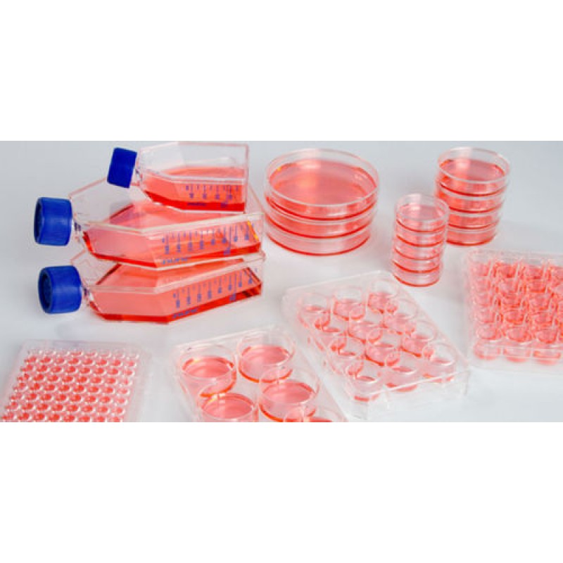 Buy Tissue Culture Dishes get price for lab equipment