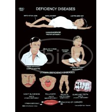 Deficiency Diseases Charts