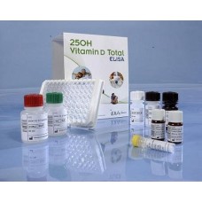 Total Vitamin D Elisa