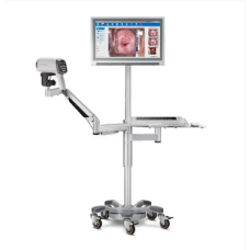 Digital Colposcope